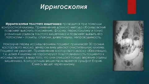Исследование толстой кишки ирригоскопия