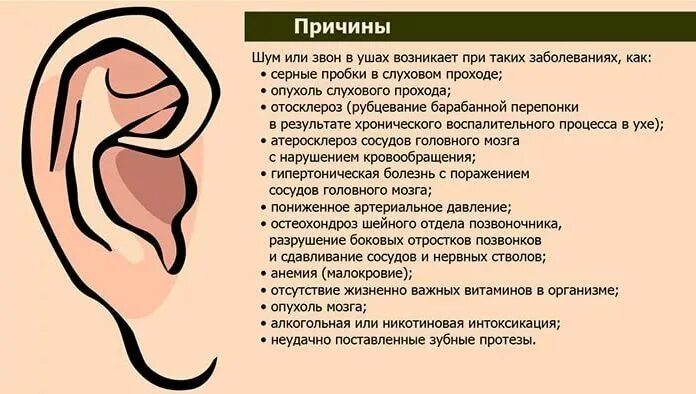 Почему в голове звенит что делать. Шум в ушах причины. Шум в ухе причины. Шумит в ушах причины. Причины возникновения шума в ушах.