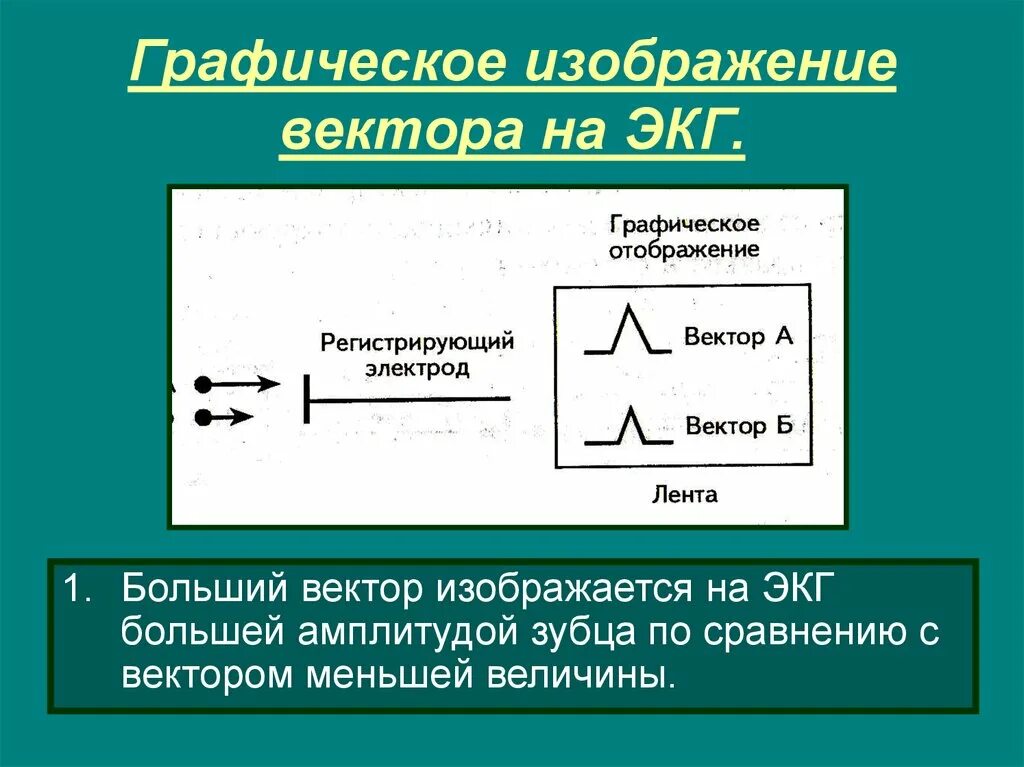 Биофизические основы экг. Биофизические основы электрокардиографии. Векторная теория формирования экг. Векторная теория экг. Теория сердечного диполя.