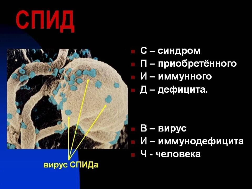 Спид ва. ВИЧ СПИД. ВИЧ доклад. ВИЧ СПИД презентация. Презентация на тему ВИЧ.