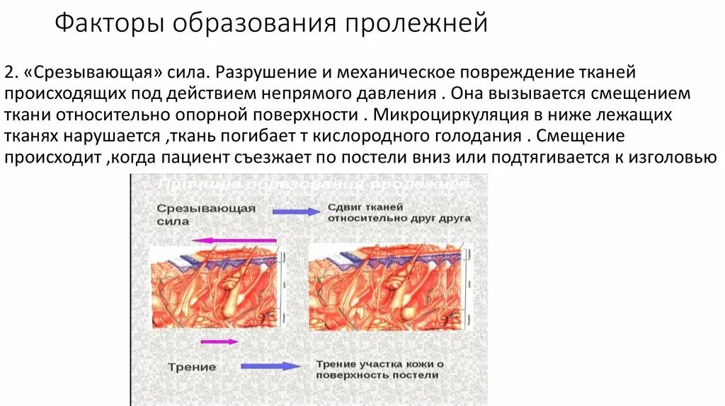 Почему образуются внутренние. Факторы образования пролежней. Факторы риска развития пролежней. Факторы риска появления пролежней. Факторы возникновения пролежней.