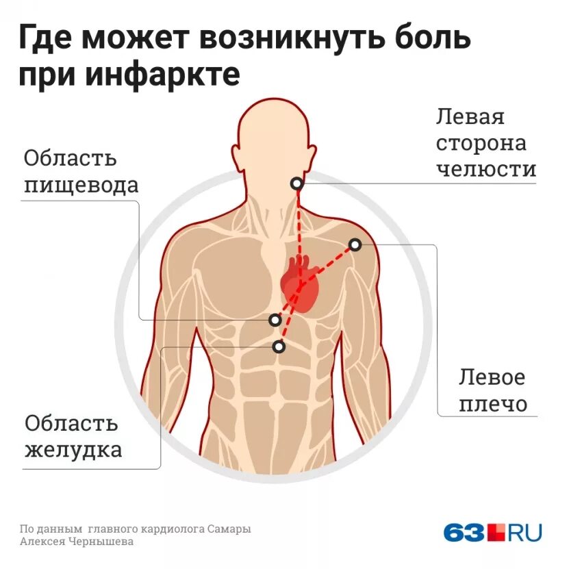 Локализация боли в сердце. Локализация сердечной боли. Боли в сердце симптомы. Почему болит сердце.