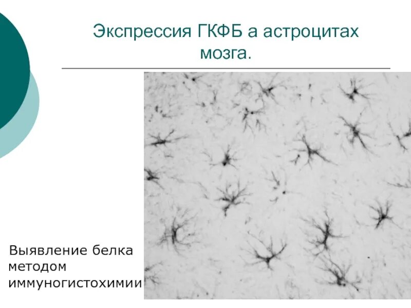 Астроциты мозга. Способ распознавания белка. Астроциты. Астроцитарная глия. Работа астроцитарной глии.