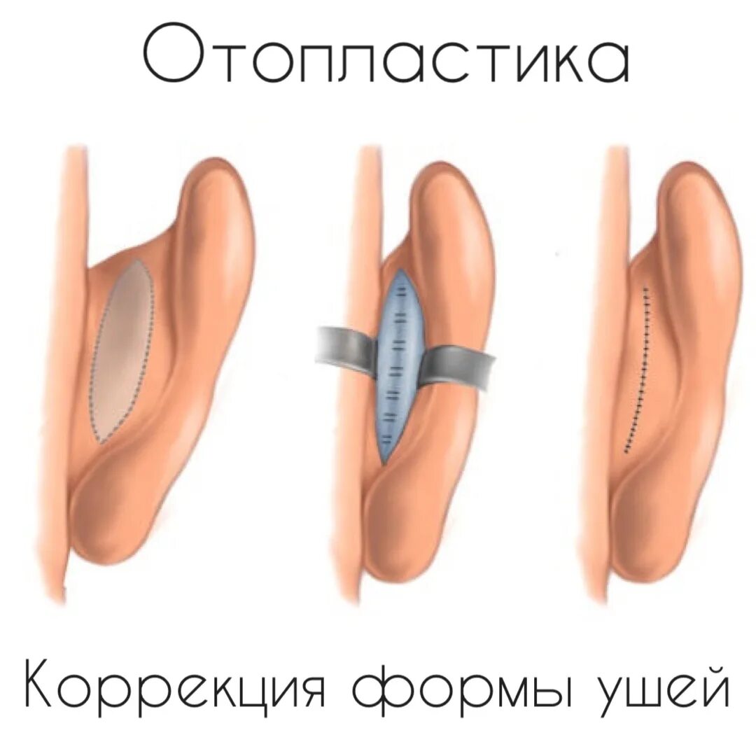 Кот прижал уши к голове. Собачий ушки поджатые. Упражнения на уши чтобы были прижаты к вескам. Кот с человеческими ушами. Поджать ушки.