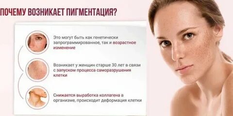 Причины пигментации на лице у женщин