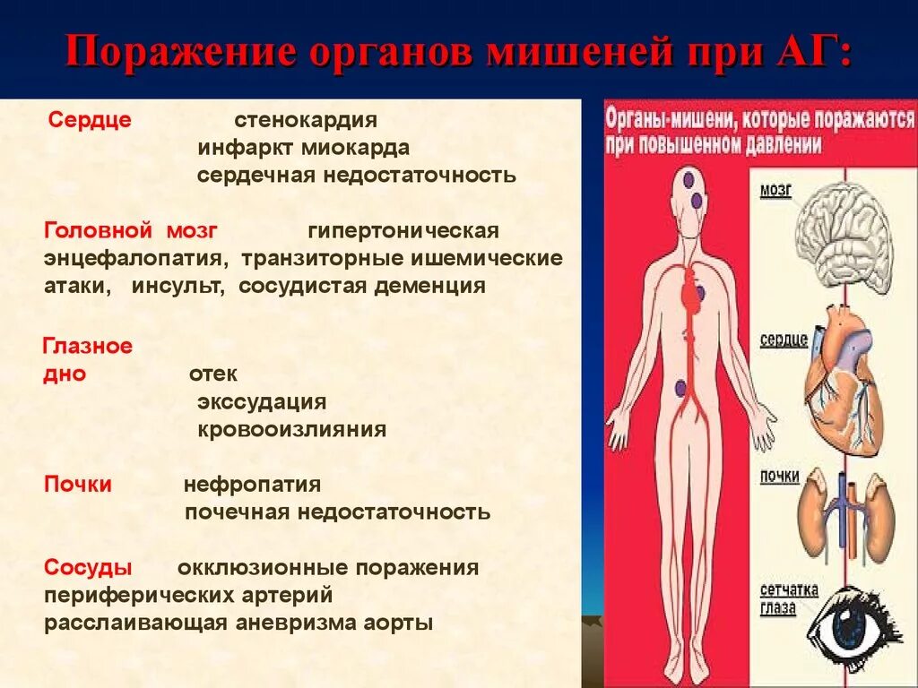 Органы мишени артериальной гипертензии. Поражение органов мишеней при артериальной гипертензии. Органы мишени при гипертонической болезни. Поражение органов мишеней при 3 стадии АГ. Признаки поражения органов мишени