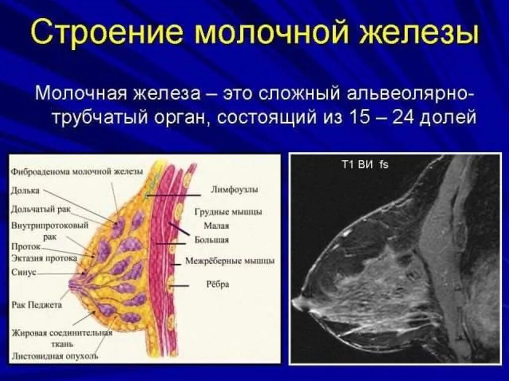 Доле груди. Строение молочной железы. Молоча яжелеза строение. Строение груди молочных желез. Железистое строение молочной железы.