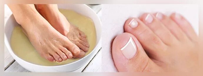 Домашние ванночки от грибка ногтей. Грибок стопы ванночки для ног. Профилактика грибка ног. Профилактика от грибка ногтей. Ванночки для ног от грибка между пальцами.