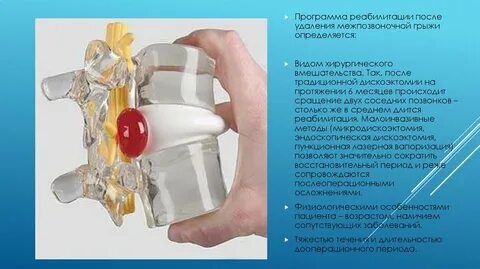 Удаление грыжи позвоночника отзывы пациентов после операции