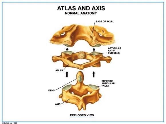 Dens axis. Анатомия c2. анатомия с2 позвонка. atlas axis. атлас аксис с1 с2.