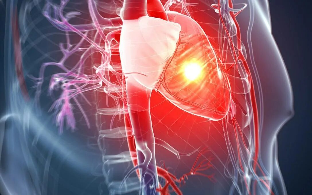 Сердечно сосудистая система стенокардия. Физиолечение при стенокардии. Серьезные заболевания сердца. Ишемическая болезнь сердца. Боль в сердце.