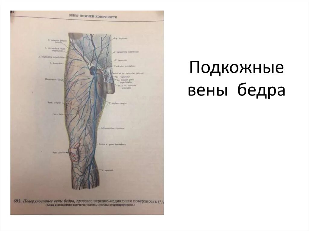 Подкожная бедренная Вена. Бедренная Вена анатомия. Поверхностная бедренная Вена анатомия. Бедренная Вена продолжается в Вену. Правая подкожная вена