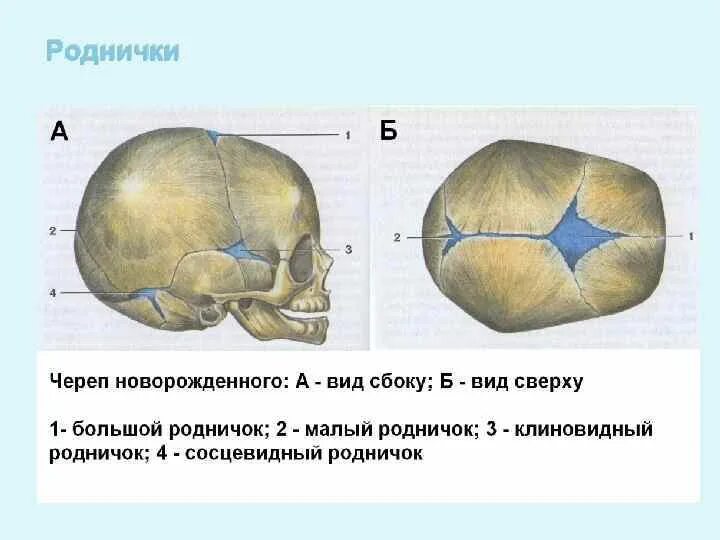 Что значит роднички. Швы и роднички черепа. Швы черепа вид сбоку. Роднички черепа новорожденного. Швы и роднички черепа анатомия.