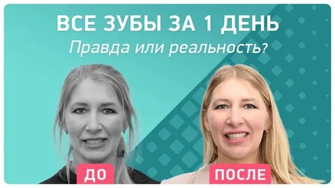 Импланты отзывы пациентов реальные