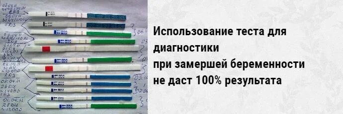 Результаты теста месяц. Тест при замершей беременности. Тест при внематочной беременности. Показывает ли тест внематочную беременность. Положительные тесты на беременность на ранних сроках.