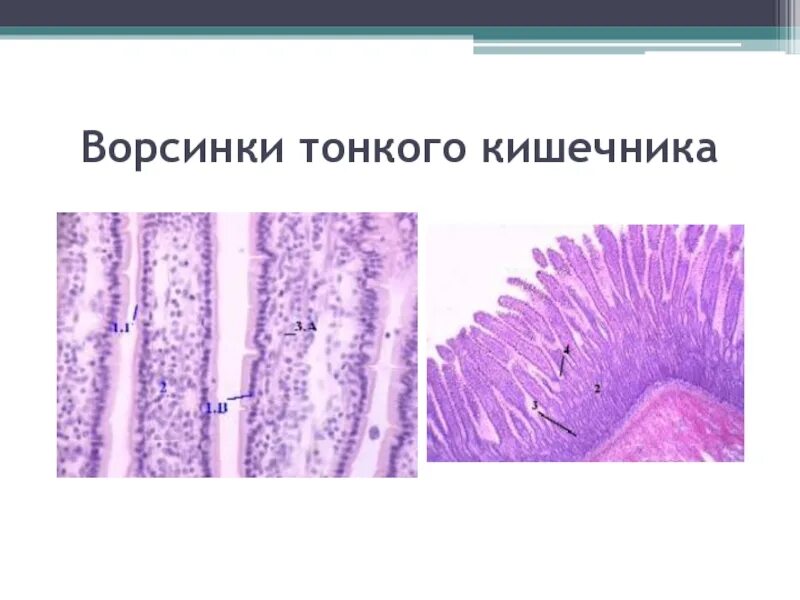 В ворсинках тонкого кишечника происходит. Ворсинки тонкого кишечника. Тонкая кишка кишечная Ворсинка. Микроворсинки тонкой кишки. Ворсинки и микроворсинки кишечника.