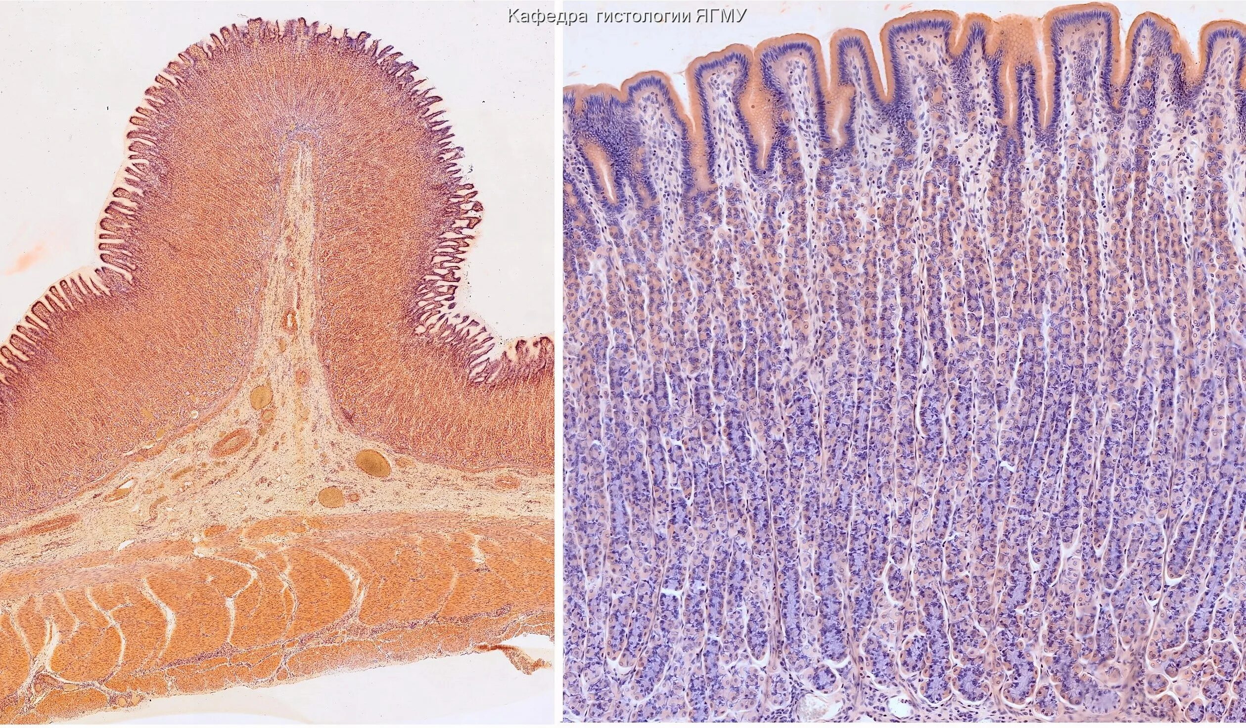 Гистология фундальной железы. Желудок гистология препарат. Эпителий желудка гистология. Пилорический отдел желудка гистология. Серозная и слизистая оболочка