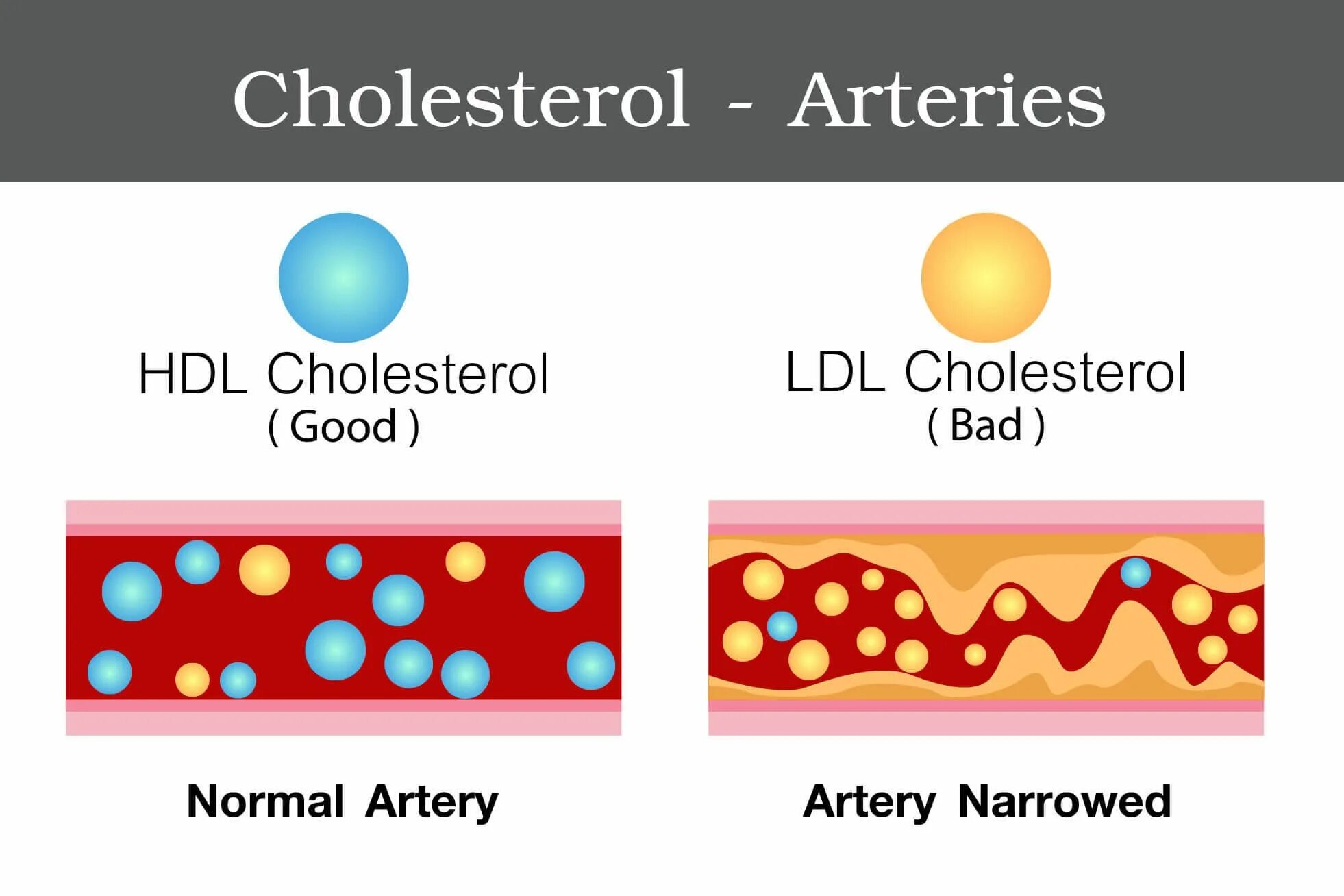 LDL холестерин что это. LDL cholesterol что это. HDL холестерин что это. LDL HDL.