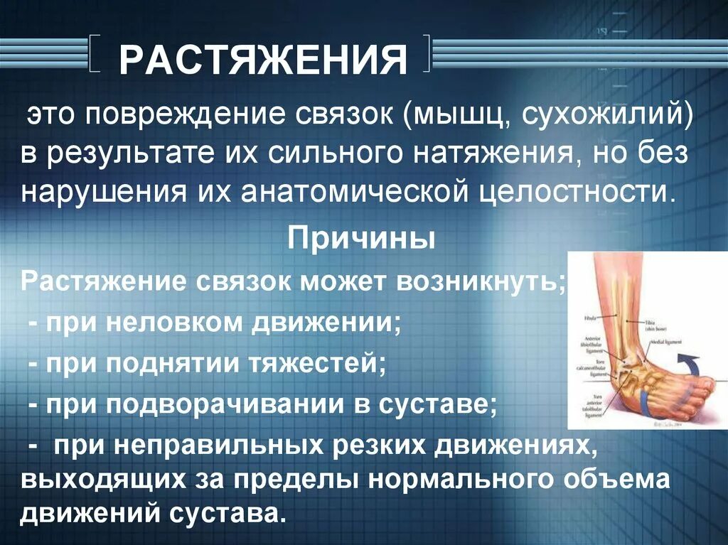 Разрыв и растяжение. Причины растяжения связок.