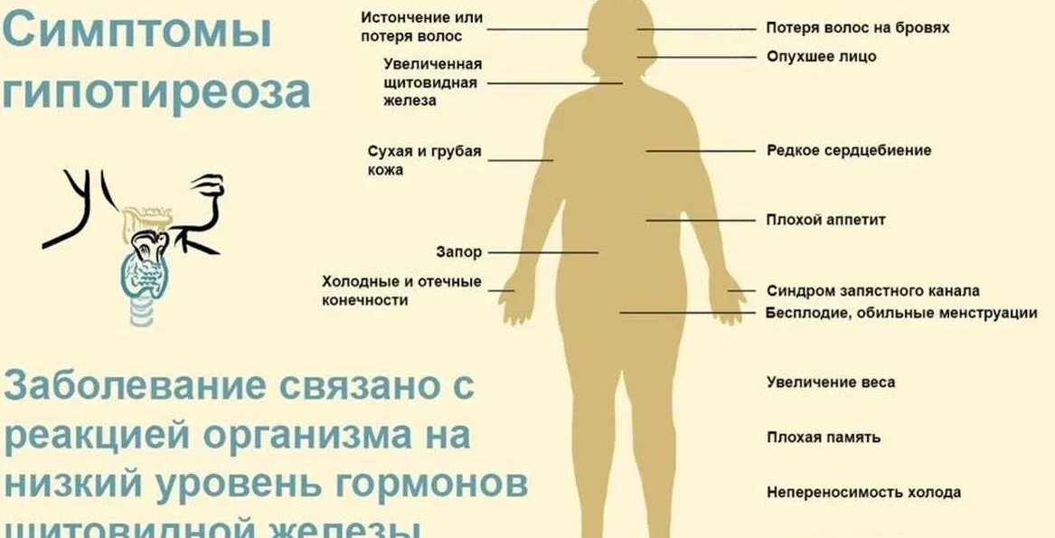 Симптомы гопотоериоза. Симптомы гипотеризоза. Гипотиреоз эндокринное заболевание. Симптомы нарушения гормонов