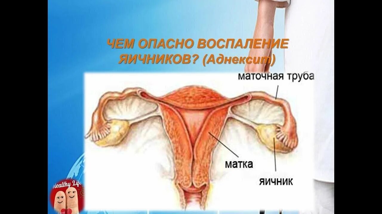 Какие симптомы при воспалении яичников у женщины. Воспаление придатков и яичников. воспаление яичников у женщин.
