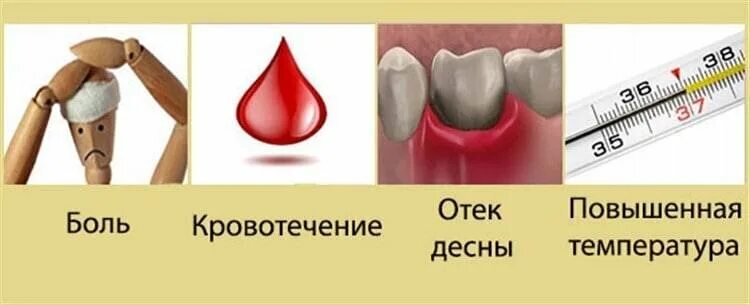 Зуб дает температуру. Нормальное заживление лунки. Воспаление лунки удаленного зуба. Заживление удаленного зуба.