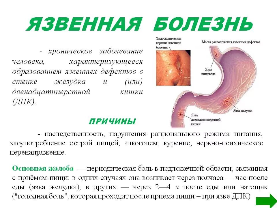 Язва значение