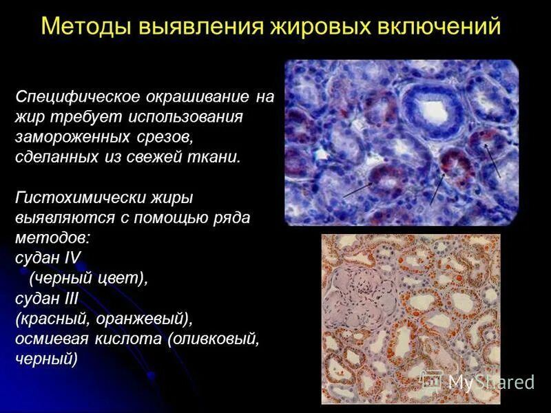 тельца включения моррисона. методика исследования вирусов. методы индикации вирусов в культуре клеток. методы выявления цитоплазматической мембраны. внутриклеточные включения тельца гварниери.