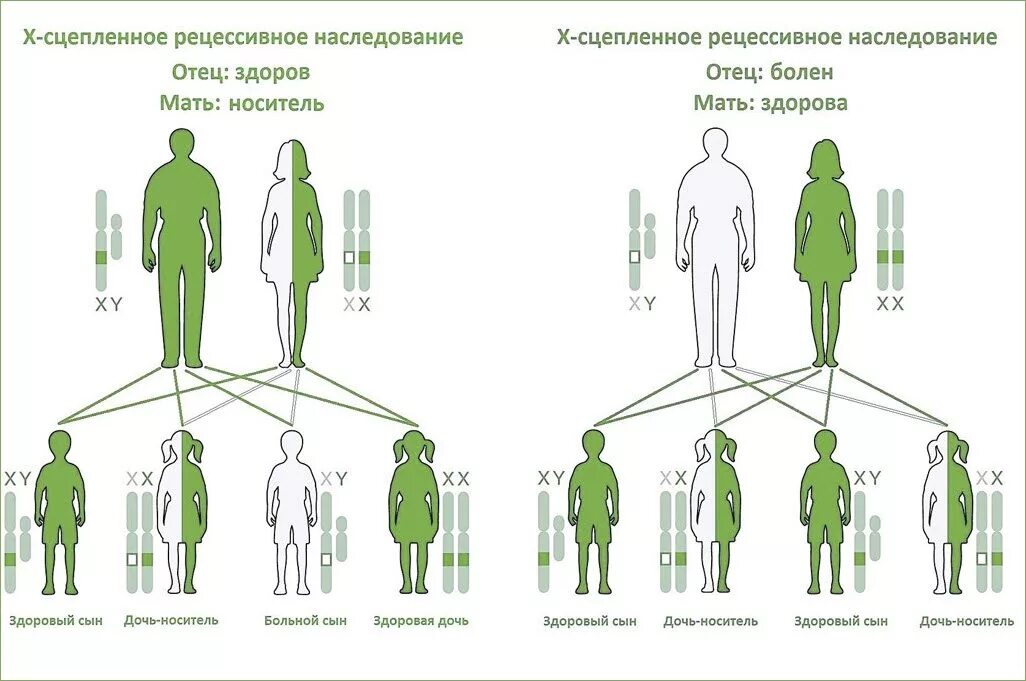 Х сцепленный рецессивный Тип наследования схема. Х рецессивный Тип наследования. Х-сцепленное рецессивное наследование схема. Аутосомно-рецессивный Тип наследования схема. Болезни по наследству от матери