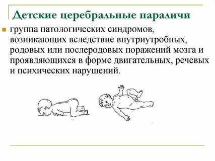 Дцп динамика