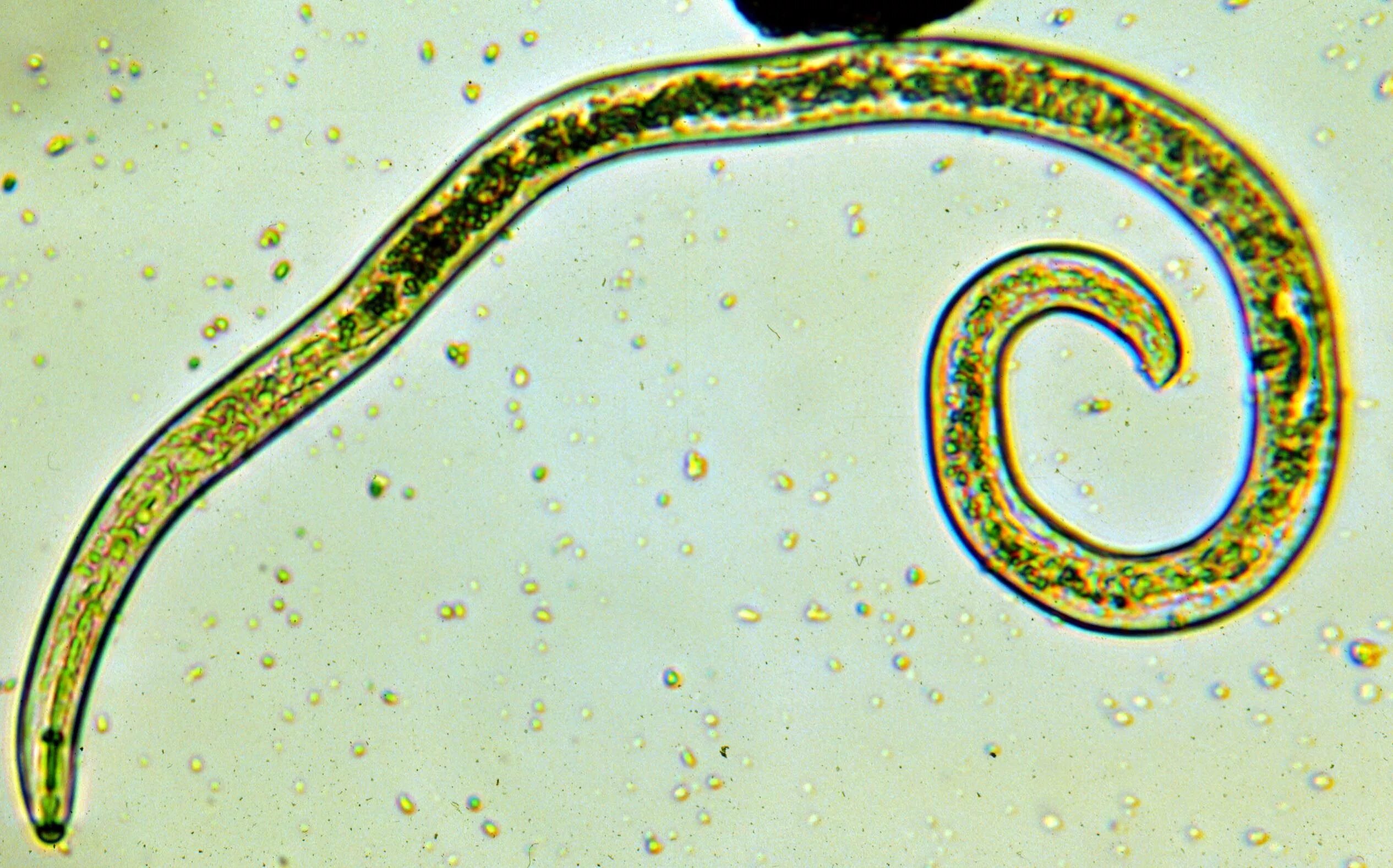 Человеческая аскарида круглый червь. Круглые черви аскарида человеческая. Nematoda (круглые черви). Глисты под микроскопом аскарида.