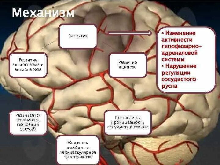 Отек мозга этиология. Отек мозга механизм развития. Отек головного мозга патогенез. Вазогенный отек мозга. Отеков мозга головы