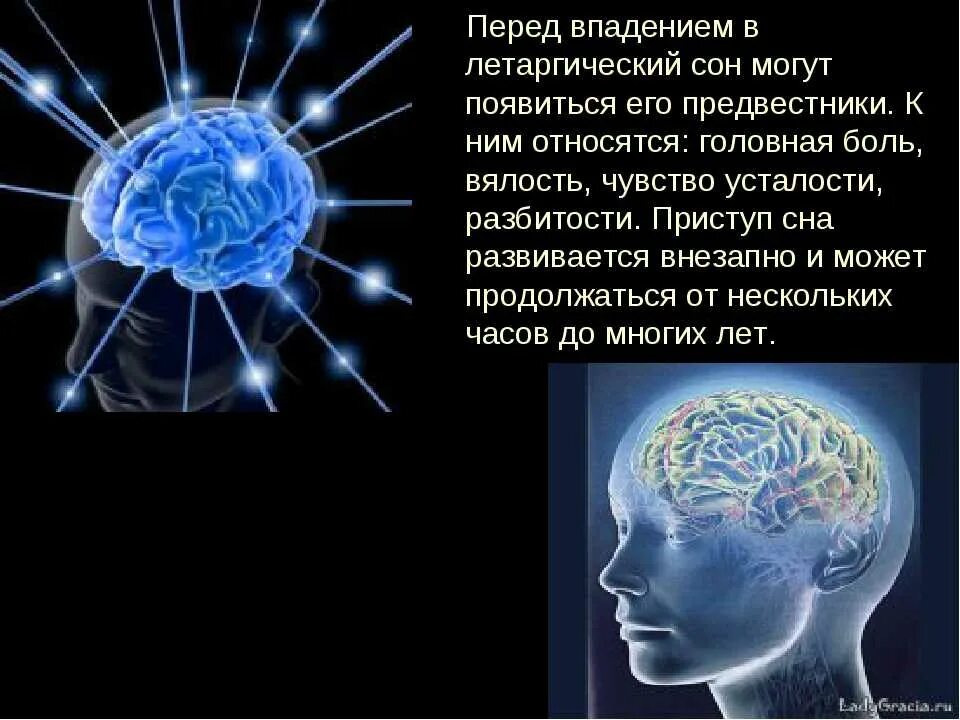 Исследование сна. Что такое летаргический сон у человека. Электросон. 8 лечение сном. 8 лечение сном.