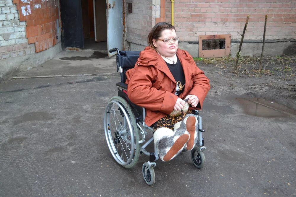 Инвалиды уроды. Женщина инвалид. Женщина инвалид на коляске. Старый инвалид.