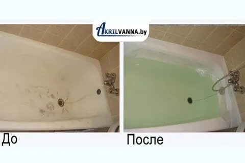 Что лучше акриловый вкладыш или акрил
