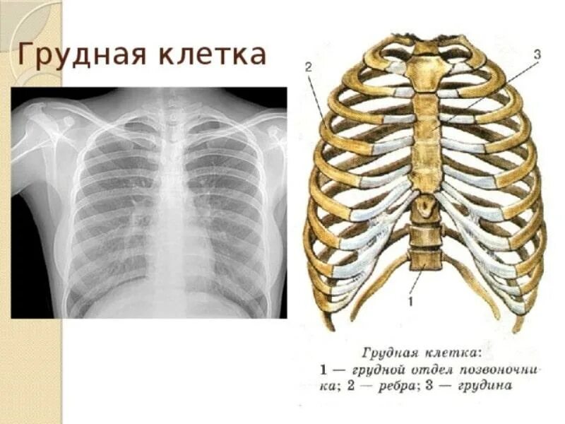 Грудная клетка мужчин и женщин. Анатомия человека грудная клетка ребра. Анатомия ребер грудной клетки. Строение ребер и грудины анатомия. Строение грудной клетки мужчины спереди.