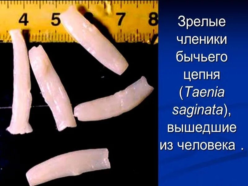 Как выглядит ленточный червь. Как выглядит ленточный червь