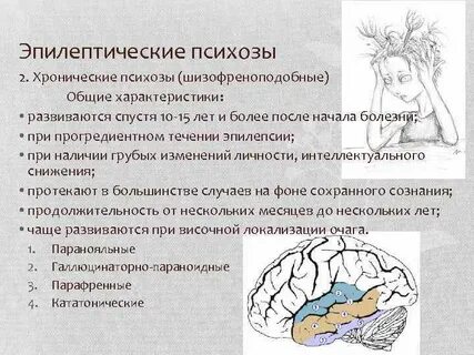 Эпилептические галлюцинации
