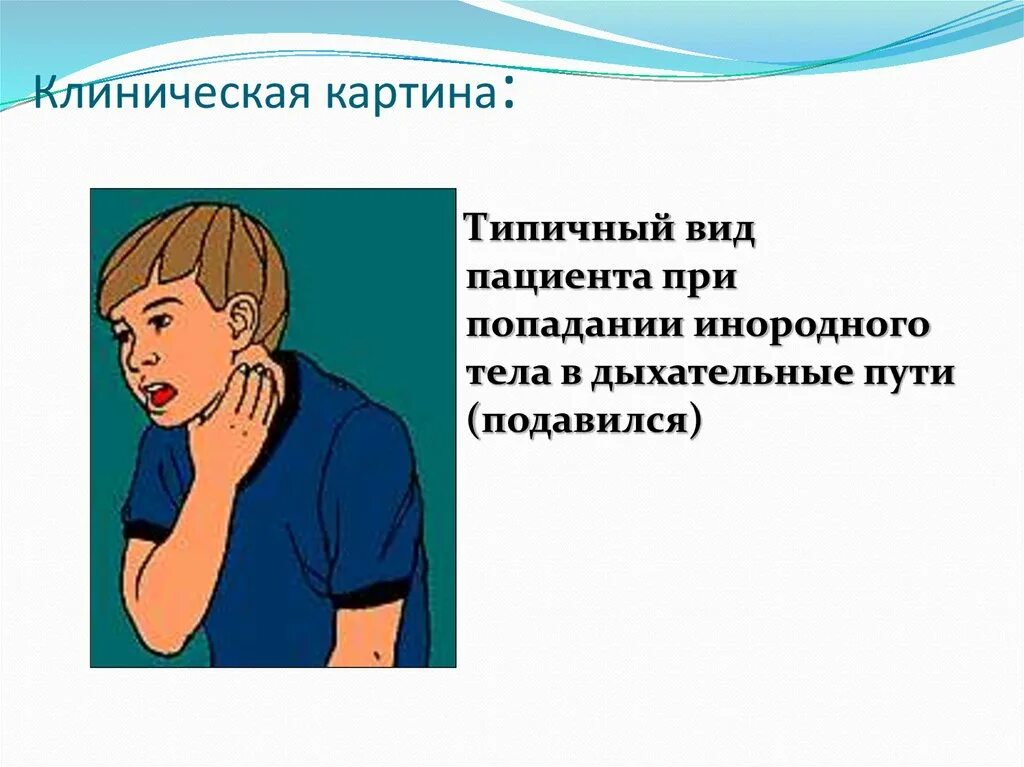 Пути попадания народного тела в Верхние дыхательные пути. Инородные тела верхних дыхательных путей. Инородное тело в дыхательных путях причины. Инородные тела верхних дыхательных путей причины. Обструкция дыхательных путей инородным телом первая помощь