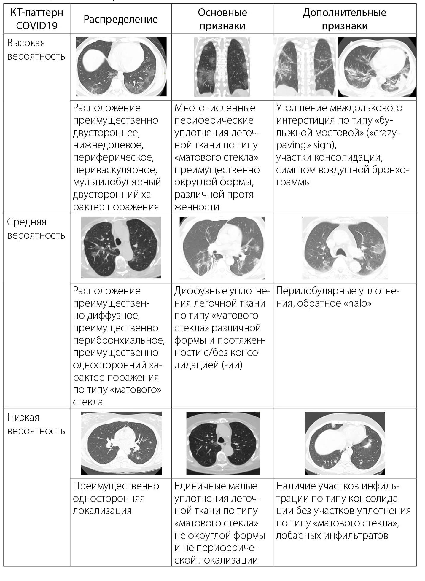 Кт 4 легкие. Степени вирусной пневмонии по кт. Стадии поражения легких по кт. Степени пневмонии на кт. Степени тяжести пневмонии по кт.