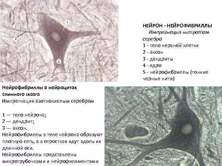 Нейрофибриллы в нервных клетках препарат. Мультиполярный Нейрон спинной мозг импрегнация серебром. Нейрофибриллы в нервных клетках спинного мозга. Нейрофибриллы в нервных клетках спинного мозга собаки.