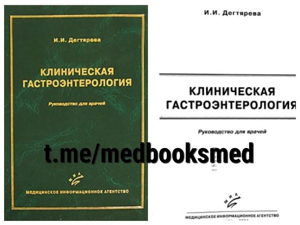 Гастроэнтерология национальное руководство. Руководство в гастроэнтерологии. Гастроэнтерология учебник. Книги по гастроэнтерологии. Книги по гастроэнтерологии для врачей.