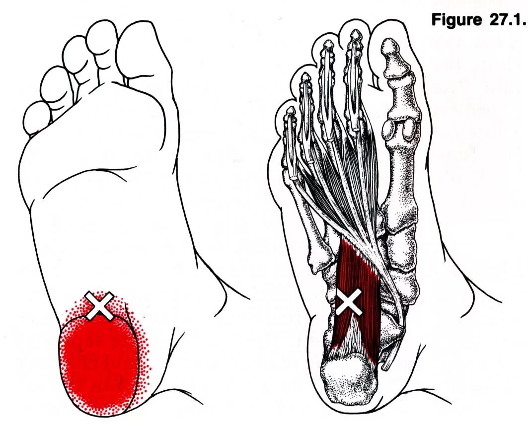 Триггерные точки мышц стопы. Триггерные точки большого пальца стопы. Триггерные точки мышц стопы и голени. Сгибатели пальцев стопы триггерные точки. Отводящий большой палец стопы