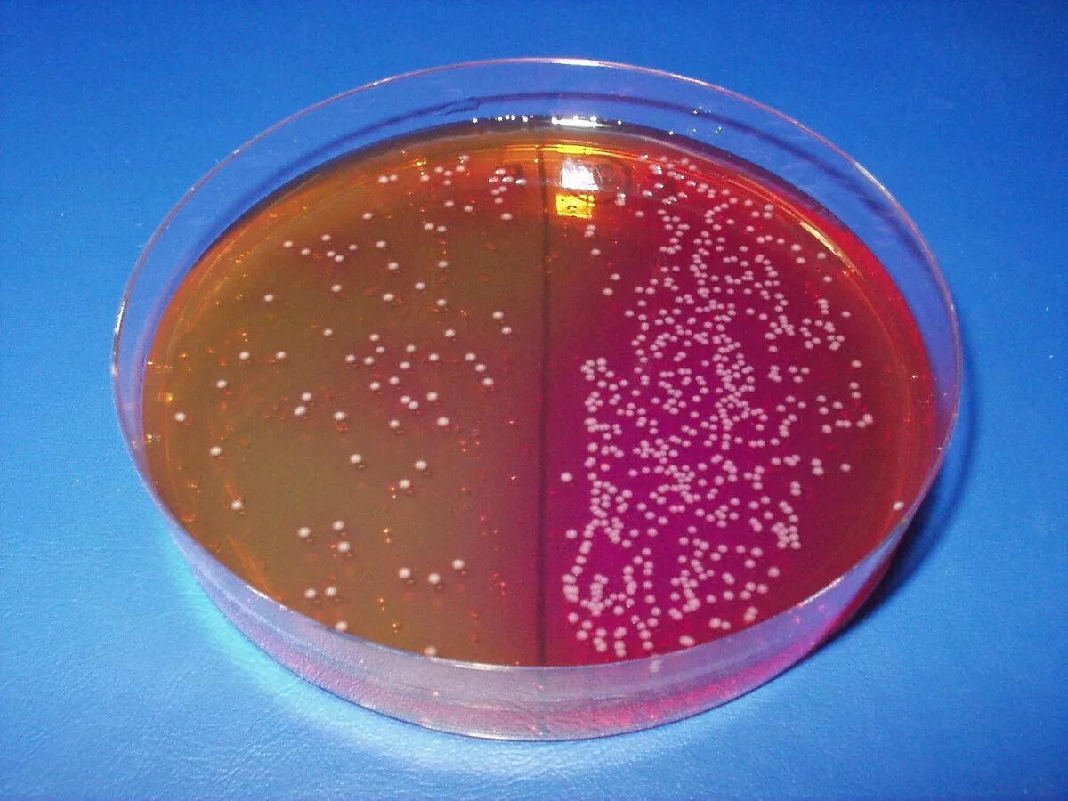 Сальмонелла Тифи на чашке Петри. Salmonella анаэроб. Сальмонелла паратифа микробиология. Сальмонелла на чашке Петри. Посев на сальмонеллез