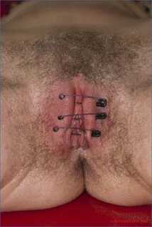 Slideshow pussy sewed shut.