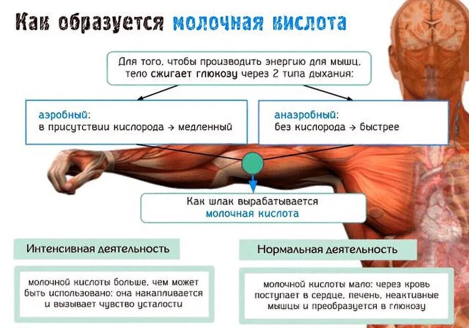 Сильные нагрузки вызовут. Как выглядит молочная кислота в мышцах. Молочная кислота в Мышха. Молочная кислота в мышцах после тренировки. Молочнокислая кислота в мышцах.