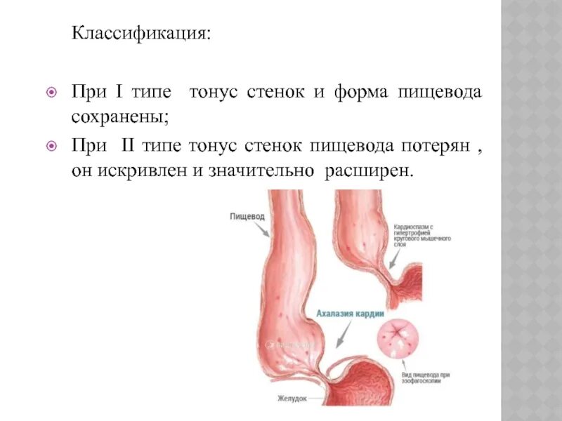 Форма пищевода