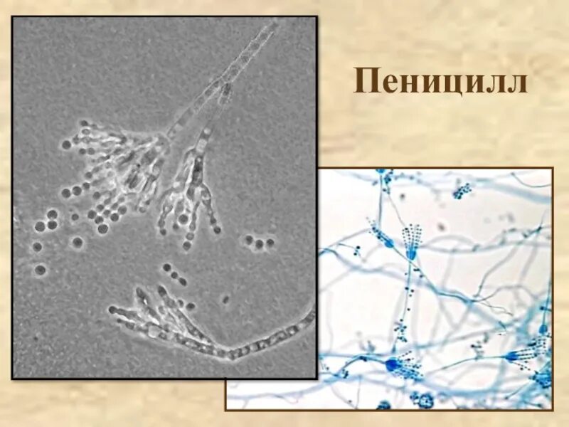 Мицелий пеницилла. Мицелий пеницилла под микроскопом. Гриб пеницилл строение. Структура пеницилла. Мицелий гриба пеницилла