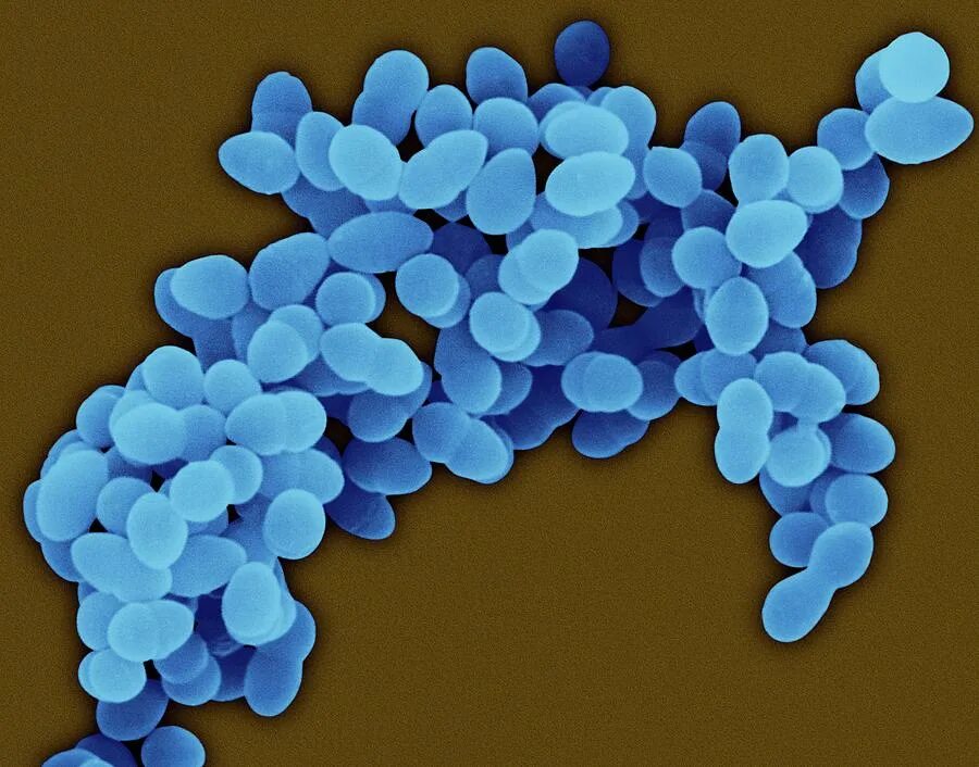 Золотистая инфекция. S. aureus золотистый стафилококк. Пневмококк золотистый стафилококк. GRSA стафилококки. Стафилококк коагулазопозитивный.