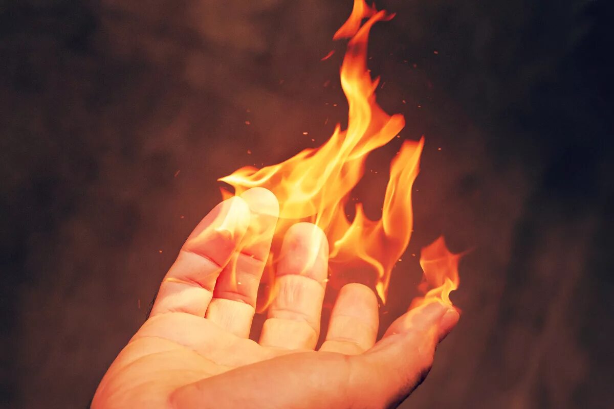 Огонь на ладони. Burned hand